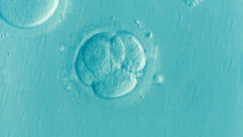 Diese 11 Fakten sollten wir kennen, bevor wir das nächste Mal über Abtreibungen reden!
